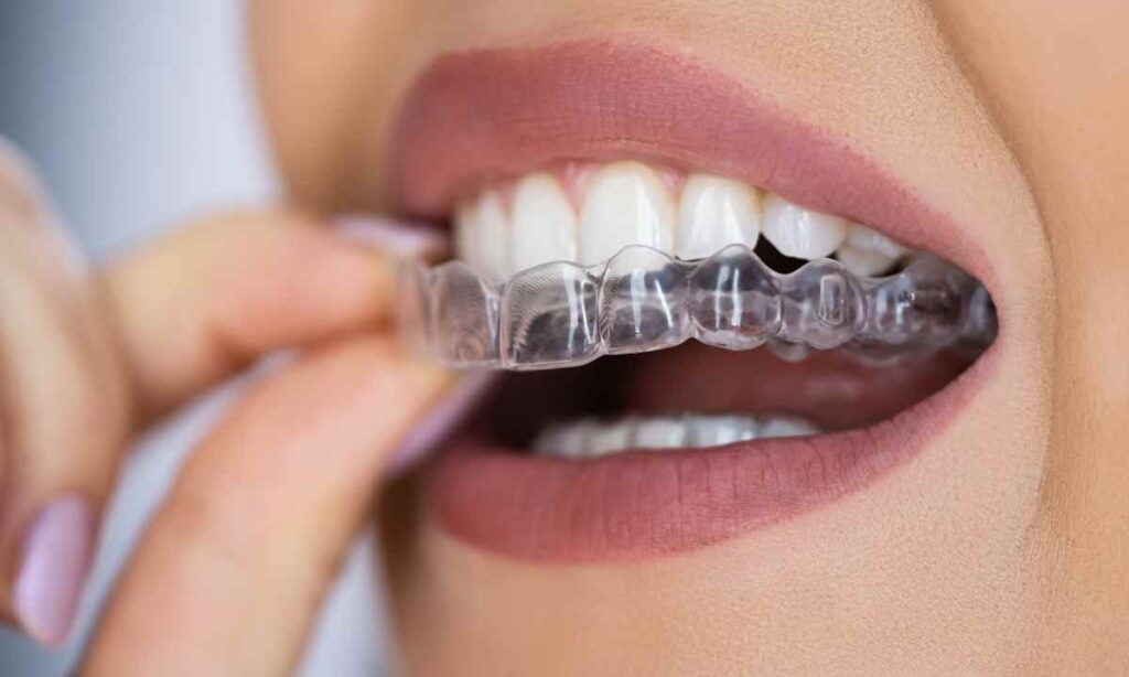 Online Dental Implant Help Blogging: Virtual Dental Implant Solutions